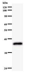 Western blot of immunized recombinant protein using LHX2 antibody.
