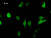 Immunostaining analysis in HeLa cells. HeLa cells were fixed with 4% paraformaldehyde and permeabilized with 0.1% Triton X-100 in PBS. The cells were immunostained with anti-LHX2 mAb.