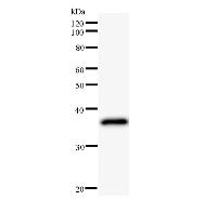 Western blot analysis of immunized recombinant protein, using anti-LHX2 monoclonal antibody.