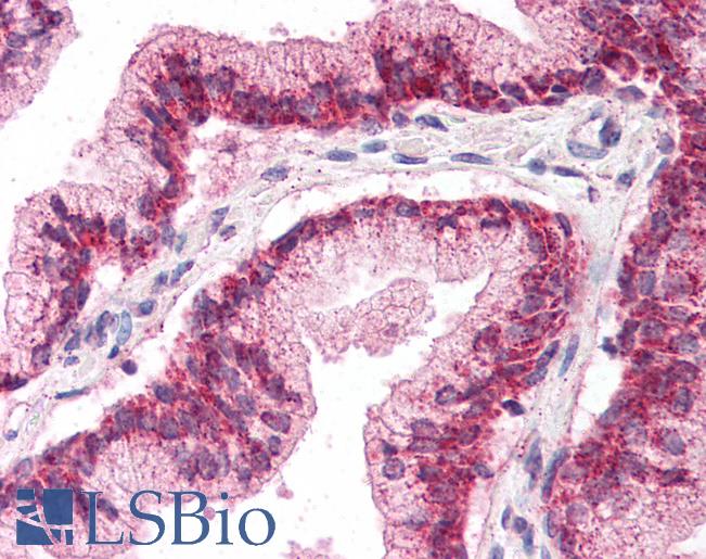 Anti-LHX2 antibody IHC of human prostate. Immunohistochemistry of formalin-fixed, paraffin-embedded tissue after heat-induced antigen retrieval. Antibody LS-B2361 concentration 5 ug/ml.