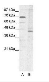 A: Marker, B: HepG2 Cell Lysate