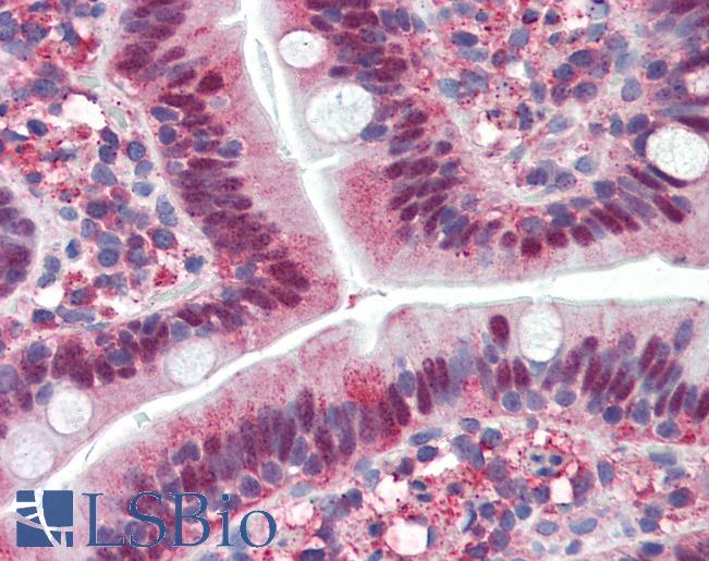 Small intestine: Formalin-Fixed, Paraffin-Embedded (FFPE)