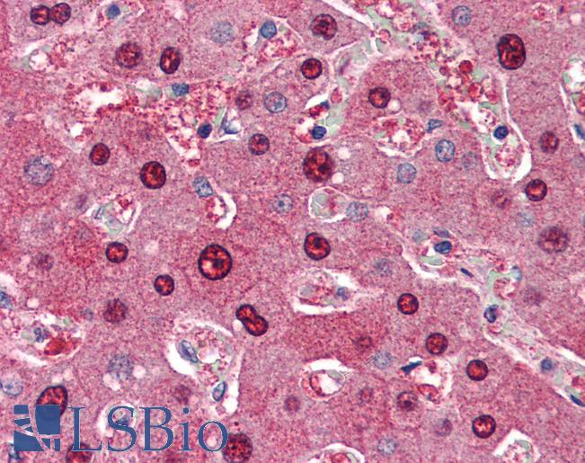Liver: Formalin-Fixed, Paraffin-Embedded (FFPE)