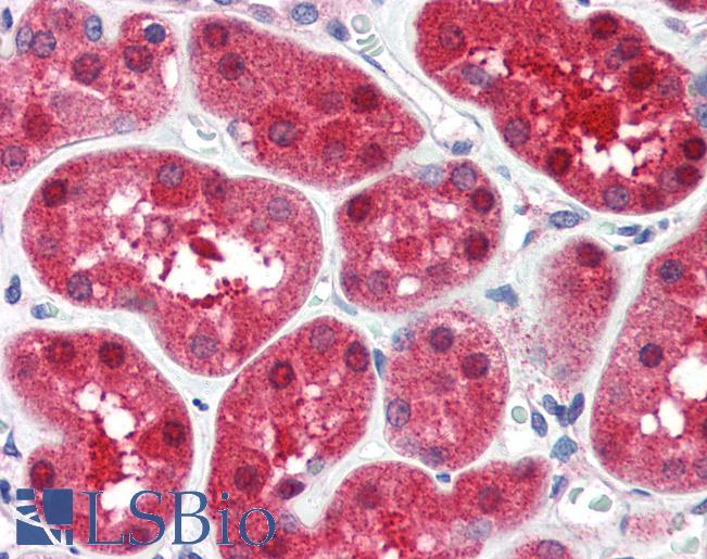 Kidney: Formalin-Fixed, Paraffin-Embedded (FFPE)
