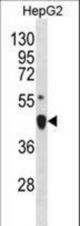 LHX4 Antibody western blot of HepG2 cell line lysates (35 ug/lane). The LHX4 antibody detected the LHX4 protein (arrow).