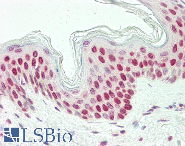 Anti-LHX6 antibody IHC staining of human skin. Immunohistochemistry of formalin-fixed, paraffin-embedded tissue after heat-induced antigen retrieval. Antibody LS-B10690 dilution 1:75.