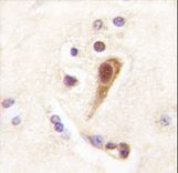 Formalin-fixed and paraffin-embedded human brain tissue reacted with Lhx6 Antibody , which was peroxidase-conjugated to the secondary antibody, followed by DAB staining. This data demonstrates the use of this antibody for immunohistochemistry; clinical relevance has not been evaluated.