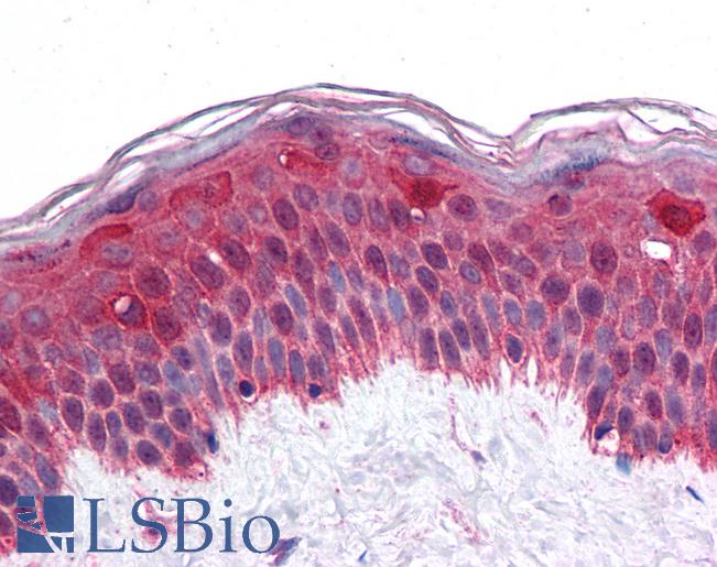 Anti-LHX8 antibody IHC of human skin. Immunohistochemistry of formalin-fixed, paraffin-embedded tissue after heat-induced antigen retrieval. Antibody LS-B4845 concentration 10 ug/ml.