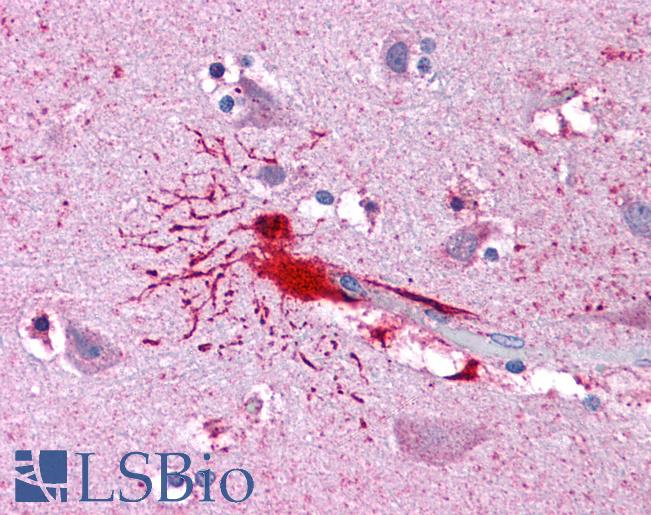 Anti-LHX8 antibody IHC of human brain, cortex. Immunohistochemistry of formalin-fixed, paraffin-embedded tissue after heat-induced antigen retrieval. Antibody LS-B4845 concentration 10 ug/ml.