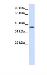 Fetal liver lysate. Antibody concentration: 1.0 ug/ml. Gel concentration: 12%.