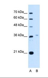 Lane A: Marker. Lane B: HepG2 cell lysate. Antibody concentration: 2.5 ug/ml. Gel concentration: 12%.