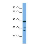 Western blot of Mouse Small Intestine. Lhx8 antibody dilution 1.0 ug/ml.