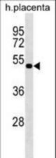 LHX8 Antibody western blot of human placenta tissue lysates (35 ug/lane). The LHX8 antibody detected the LHX8 protein (arrow).