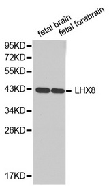 Western blot analysis of extracts of various cell lines, using LHX8antibody.