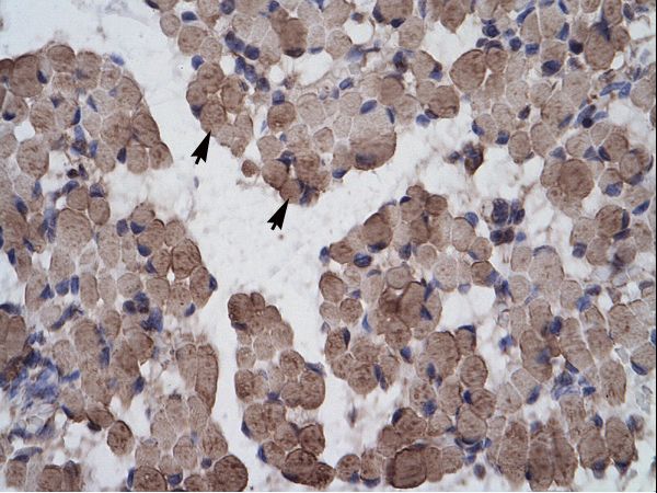 LHX9 antibody LS-C31600 was used in IHC to stain formalin-fixed, paraffin-embedded human muscle.
