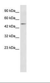 Jurkat Cell Lysate