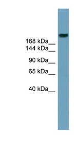 ABCA12 antibody LS-C110807 Western blot of Fetal Stomach lysate.