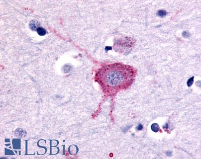 Anti-GRM2 / MGLUR2 antibody LS-A6735 IHC of human brain, neurons and glia. Immunohistochemistry of formalin-fixed, paraffin-embedded tissue after heat-induced antigen retrieval.