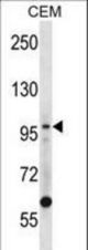 LIG1 Antibody western blot of CEM cell line lysates (35 ug/lane). The LIG1 antibody detected the LIG1 protein (arrow).