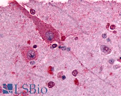 Anti-GRM2 / MGLUR2 antibody LS-A895 IHC of human brain, neurons and glia. Immunohistochemistry of formalin-fixed, paraffin-embedded tissue after heat-induced antigen retrieval.