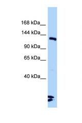 LIG3 antibody LS-C146277 Western blot of Mouse Heart lysate. Antibody concentration 1 ug/ml.