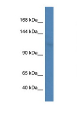 LIG3 antibody LS-C135328 Western blot of Rat Kidney lysate. Antibody concentration 1 ug/ml.