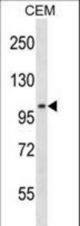 LIG3 Antibody western blot of CEM cell line lysates (35 ug/lane). The LIG3 antibody detected the LIG3 protein (arrow).