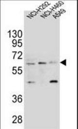 LILRA2 Antibody western blot of NCI-H292,NCI-H460 and A549 cell line lysates (35 ug/lane). The LILRA2 antibody detected the LILRA2 protein (arrow).