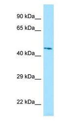LILRA3 antibody Western Blot of Human Kidney.