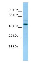 LILRA3 antibody Western Blot of OVCAR-3.