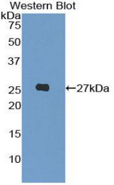 Western blot of recombinant LILRA3.
