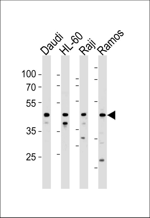 LILRA3 Antibody western blot of Daudi,HL-60,Raji and Ramos cell line lysates (35 ug/lane). The LILRA3 antibody detected the LILRA3 protein (arrow).