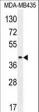 LILRA5 Antibody western blot of MDA-MB435 cell line lysates (35 ug/lane). The LILRA5 antibody detected the LILRA5 protein (arrow).