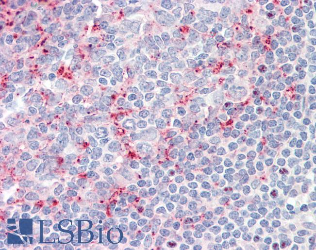 Anti-LILRB2 / ILT4 antibody IHC staining of human tonsil. Immunohistochemistry of formalin-fixed, paraffin-embedded tissue after heat-induced antigen retrieval. Antibody LS-B9762 concentration 10 ug/ml.