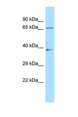 LILRB2 antibody Western blot of Fetal Brain lysate. Antibody concentration 1 ug/ml.