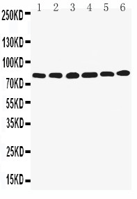 WB of LIM Protein / LPP antibody. Lane 1: SMMC Cell Lysate. Lane 2: HELA Cell Lysate. Lane 3: SW620 Cell Lysate. Lane 4: A549 Cell Lysate. Lane 5: SKOV Cell Lysate. Lane 6: MCF-7 Cell Lysate..