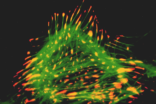 Immunocytochemical staining of a rat cardiac fibroblast using anti-Lipoma Preferred Partner, pAb (IG-817) (LPP; red fluorescence) and a green-fluorescent phalloidin derivative staining filamentous actin. LPP is a protein related to the cytoskeletal and focal adhesion protein zyxin.