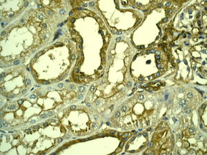 IHC of paraffin-embedded human kidney tissue using anti-LPP antibody.