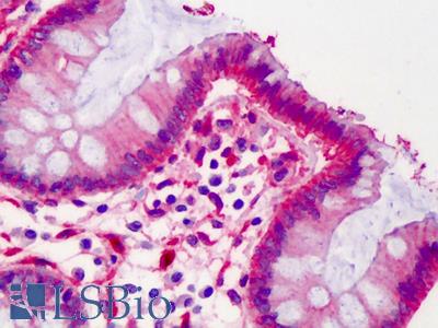 Anti-LPP antibody IHC of human colon. Immunohistochemistry of formalin-fixed, paraffin-embedded tissue after heat-induced antigen retrieval. Antibody LS-B3472 dilution 1:200.