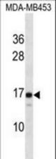 LIM2 Antibody western blot of MDA-MB453 cell line lysates (35 ug/lane). The LIM2 antibody detected the LIM2 protein (arrow).