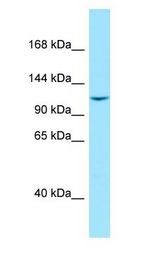 LIMCH1 antibody Western Blot of THP-1 cell lysate.