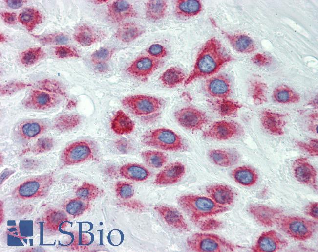 Anti-LIMD1 antibody IHC of human placenta. Immunohistochemistry of formalin-fixed, paraffin-embedded tissue after heat-induced antigen retrieval. Antibody LS-B4017 concentration 5 ug/ml.