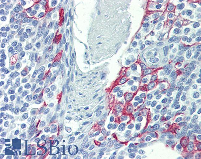 Anti-LIMD1 antibody IHC of human tonsil. Immunohistochemistry of formalin-fixed, paraffin-embedded tissue after heat-induced antigen retrieval. Antibody LS-B4017 concentration 5 ug/ml.