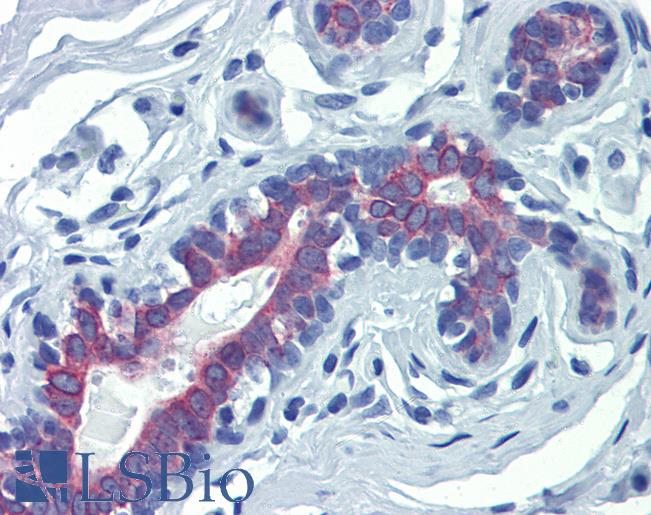 Anti-LIMD1 antibody IHC of human breast. Immunohistochemistry of formalin-fixed, paraffin-embedded tissue after heat-induced antigen retrieval. Antibody LS-B4017 concentration 5 ug/ml.