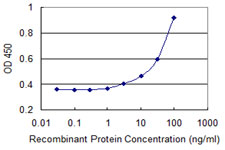 Detection limit for recombinant GST tagged LIMD1 is 1 ng/ml as a capture antibody.
