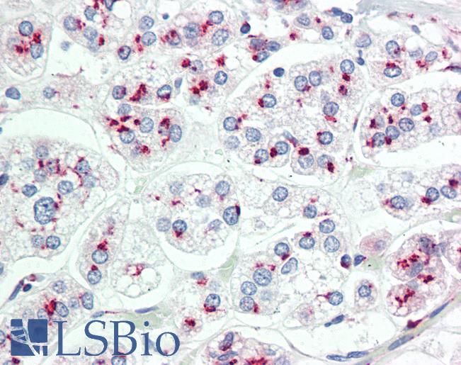 Anti-LIMD1 antibody IHC staining of human adrenal. Immunohistochemistry of formalin-fixed, paraffin-embedded tissue after heat-induced antigen retrieval. Antibody LS-B9619 dilution 1:100.