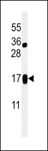 Western blot of LIMD2 Antibody in Jurkat cell line lysates (35 ug/lane). LIMD2 (arrow) was detected using the purified antibody.
