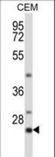 LIME1 Antibody western blot of CEM cell line lysates (35 ug/lane). The LIME1 antibody detected the LIME1 protein (arrow).