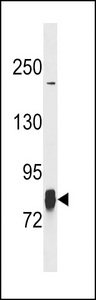 LIMK1 Antibody (T9) western blot of SK-BR-3 cell line lysates (35 ug/lane). The LIMK1 antibody detected the LIMK1 protein (arrow).