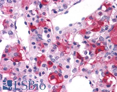 Anti-GRM3 / MGLUR3 antibody LS-A899 IHC of human brain, pituitary. Immunohistochemistry of formalin-fixed, paraffin-embedded tissue after heat-induced antigen retrieval.